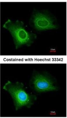Immunocytochemistry/Immunofluorescence: CYP2R1 Antibody [NBP1-32883] - Analysis of methanol-fixed HeLa, using antibody at 1:200 dilution.