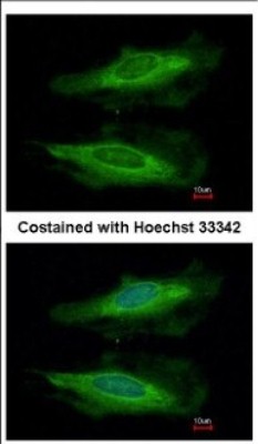 Immunocytochemistry/Immunofluorescence: HECA Antibody [NBP2-16800] - Immunofluorescence analysis of methanol-fixed HeLa, using antibody at 1:200 dilution.