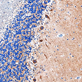 MEGF9 was detected in immersion fixed paraffin-embedded sections of human brain (cerebellum) using Sheep Anti-Human MEGF9 Antigen Affinity-purified Polyclonal Antibody (Catalog # AF7768) at 1 µg/mL overnight at 4 °C. Before incubation with the primary antibody, tissue was subjected to heat-induced epitope retrieval using Antigen Retrieval Reagent-Basic (Catalog # CTS013). Tissue was stained using the Anti-Sheep HRP-DAB Cell & Tissue Staining Kit (brown; Catalog # CTS019) and counterstained with hematoxylin (blue). Specific staining was localized to Purkinje neurons. View our protocol for Chromogenic IHC Staining of Paraffin-embedded Tissue Sections.