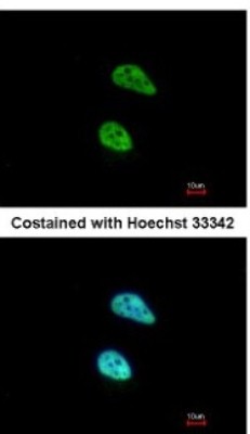 Immunocytochemistry/Immunofluorescence: PATZ Antibody [NBP2-19709] - Analysis of paraformaldehyde-fixed HeLa, using antibody at 1:200 dilution.