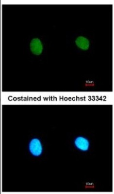 Immunocytochemistry/Immunofluorescence: MED18 Antibody [NBP2-17257] - Analysis of paraformaldehyde-fixed HeLa, using antibody at 1:200 dilution.