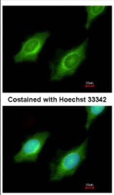 Immunocytochemistry/Immunofluorescence: Cytochrome P450 4A Antibody [NBP2-16081] - Immunofluorescence analysis of methanol-fixed HeLa, using antibody at 1:200 dilution.