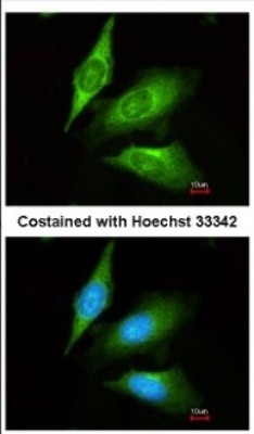 Immunocytochemistry/Immunofluorescence: TMED4 Antibody [NBP2-20661] - Immunofluorescence analysis of methanol-fixed HeLa, using antibody at 1:200 dilution.