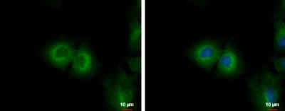Immunocytochemistry/Immunofluorescence: Cytochrome P450 4F11 Antibody [NBP2-16082] - A549 cells were fixed in 4% paraformaldehyde at RT for 15 min. Green: CYP4F11 protein stained by CYP4F11 antibody [N1N3] diluted at 1:200. Blue: Hoechst 33342 staining. Scale bar = 10 um.
