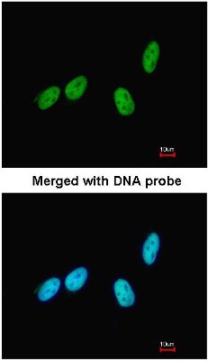 Immunocytochemistry/Immunofluorescence: RED Antibody [NBP1-30927] - Analysis of HeLa, using NBP1-30927 at 1:200 dilution.