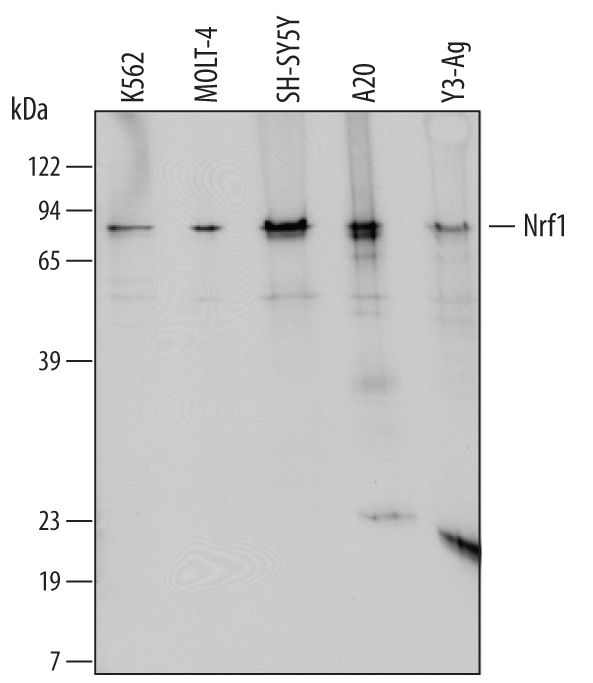 Western blot shows lysates of K562 human chronic myelogenous leukemia cell line, MOLT‑4 human acute lymphoblastic leukemia cell line, SH‑SY5Y human neuroblastoma cell line, A20 mouse B cell lymphoma cell line, and Y3‑Ag rat myeloid cell line. PVDF membrane was probed with 2 µg/mL of Mouse Anti-Human/Mouse/Rat Nrf1 Monoclonal Antibody (Catalog # MAB5306) followed by HRP-conjugated Anti-Mouse IgG Secondary Antibody (Catalog # HAF007). A specific band was detected for Nrf1 at approximately 85 kDa (as indicated). This experiment was conducted under reducing conditions and using Immunoblot Buffer Group 3.