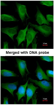 Immunocytochemistry/Immunofluorescence: FGD4 Antibody [NBP1-31335] - Analysis of HeLa, using NBP1-31335 at 1:200 dilution.