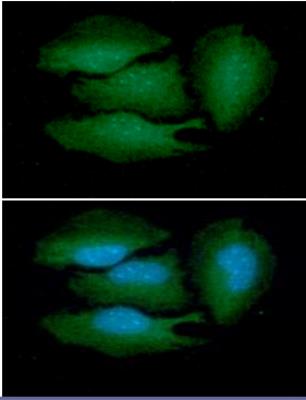 Immunocytochemistry/Immunofluorescence: BRCC3 Antibody (3B1) [NBP1-30429] - CC/IF analysis of BRCC36 in HeLa cells line, stained with DAPI (Blue) for nucleus staining and monoclonal anti-human BRCC36 antibody (1:100) with goat anti-mouse IgG-Alexa fluor 488 conjugate (Green).