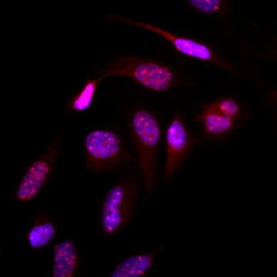 Immunocytochemistry/Immunofluorescence: SUMO 2/3 Antibody (10F1) [NBP2-22546] - Immunofluorescence of human HeLa cells stained with Hoechst 3342 (Blue) for nucleus staining and monoclonal anti-human SUMO2/3 antibody (1:500) with Texas Red (Red).