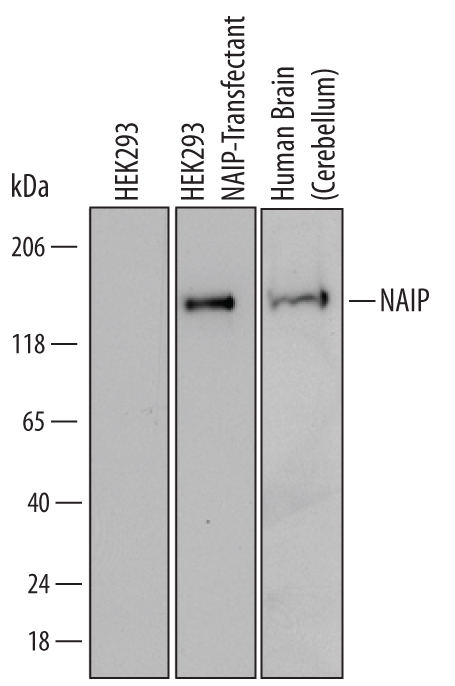 Western blot shows lysates of HEK293 human embryonic kidney cell line either mock transfected or transfected with human NAIP and human brain (cerebellum) tissue. PVDF Membrane was probed with 1 µg/mL of Human NAIP Monoclonal Antibody (Catalog # MAB829) followed by HRP-conjugated Anti-Mouse IgG Secondary Antibody (Catalog # HAF007). A specific band was detected for NAIP at approximately 160 kDa (as indicated). This experiment was conducted under reducing conditions and using Immunoblot Buffer Group 2.