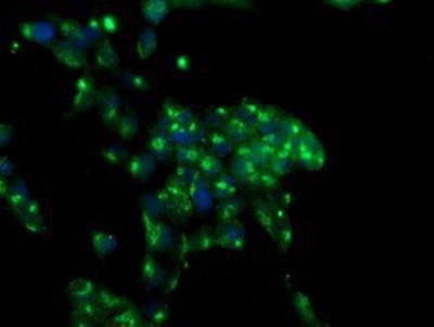 Immunocytochemistry/Immunofluorescence: MIF4GD Antibody (4C11) [NBP2-01876] - Immunofluorescent staining of HeLa cells using anti-MIF4GD mouse monoclonal antibody.