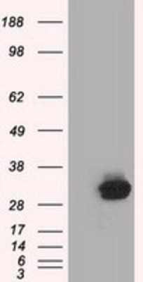 Western Blot: C21orf59 Antibody (2H5) [NBP2-02702] - HEK293T cells were transfected with the pCMV6-ENTRY control (Left lane) or pCMV6-ENTRY C21orf59 (Right lane) cDNA for 48 hrs and lysed. Equivalent amounts of cell lysates (5 ug per lane) were separated by SDS-PAGE and immunoblotted with anti-C21orf59.