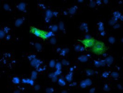 Immunocytochemistry/Immunofluorescence: CARKL Antibody (3D7) [NBP2-00986] Staining of COS7 cells transiently transfected by pCMV6-ENTRY CARKL.