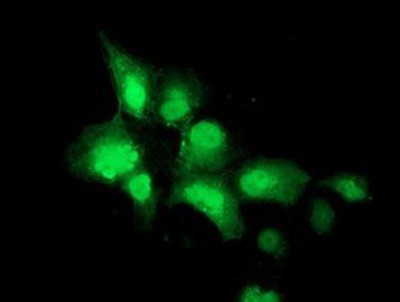 Immunocytochemistry/Immunofluorescence: NEU2 Antibody (4F4) [NBP2-00783] Staining of COS7 cells transiently transfected by pCMV6-ENTRY NEU2.