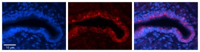Immunocytochemistry/Immunofluorescence: Ribophorin II Antibody [NBP1-62480] - Formalin Fixed Paraffin Embedded Tissue: Human Bronchial Epithelial Tissue  Observed Staining: Cytoplasmic