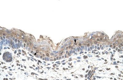 Immunohistochemistry-Paraffin: Ribophorin II Antibody [NBP1-62480] - Human Skin Tissue Squamous epithelial cells (Indicated with Arrows), 4-8ug/ml.