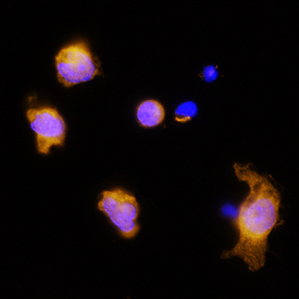 IL‑3 was detected in immersion fixed rat splenocytes using Goat Anti-Rat IL‑3 Antigen Affinity-purified Polyclonal Antibody (Catalog # AF2524) at 15 µg/mL for 3 hours at room temperature. Cells were stained using the NorthernLights™ 557-conjugated Anti-Goat IgG Secondary Antibody (yellow; Catalog # NL001) and counterstained with DAPI (blue). Specific staining was localized to cytoplasm. View our protocol for Fluorescent ICC Staining of Non-adherent Cells.