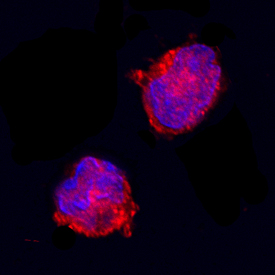 IL‑1ra/IL‑1F3 was detected in immersion fixed equine peripheral blood mononuclear cells (PBMCs) using Goat Anti-Equine IL‑1ra/IL‑1F3 Antigen Affinity-purified Polyclonal Antibody (Catalog # AF2466) at 15 µg/mL for 3 hours at room temperature. Cells were stained using the Northern­Lights™ 557-conjugated Anti-Goat IgG Secondary Antibody (red; Catalog # NL001) and counterstained with DAPI (blue). Specific staining was localized to plasma membrane. View our protocol for Fluorescent ICC Staining of Non-adherent Cells.