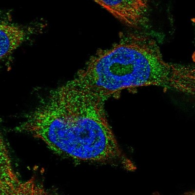 Immunocytochemistry/Immunofluorescence: PDSS2 Antibody [NBP1-88740] - Immunofluorescent staining of human cell line U-251 MG shows localization to cytosol.