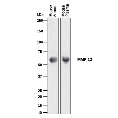 Western blot shows mouse serum and mouse plasma. PVDF membrane was probed with 2 µg/mL of Goat Anti-Mouse MMP‑12 Antigen Affinity-purified Polyclonal Antibody (Catalog # AF3467) followed by HRP-conjugated Anti-Goat IgG Secondary Antibody (Catalog # HAF017). A specific band was detected for MMP‑12 at approximately 55 kDa (as indicated). This experiment was conducted under reducing conditions and using Immunoblot Buffer Group 1.