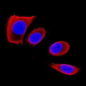 Chondrolectin was detected in immersion fixed PC‑3 human prostate cancer cell line using Mouse Anti-Human Chondrolectin Monoclonal Antibody (Catalog # MAB2576) at 25 µg/mL for 3 hours at room temperature. Cells were stained using the NorthernLights™ 557-conjugated Anti-Mouse IgG Secondary Antibody (red; Catalog # NL007) and counterstained with DAPI (blue). Specific staining was localized to cytoplasm and plasma membranes. View our protocol for Fluorescent ICC Staining of Cells on Coverslips.