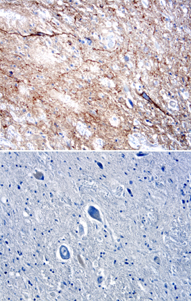 DPP6 was detected in immersion fixed paraffin-embedded sections of human spinal cord using Goat Anti-Human DPP6 Antigen Affinity-purified Polyclonal Antibody (Catalog # AF2360) at 5 µg/mL overnight at 4 °C. Tissue was stained using the Anti-Goat HRP-DAB Cell & Tissue Staining Kit  (brown; Catalog # CTS008) and counterstained with hematoxylin (blue). Lower panel shows a lack of labeling when primary antibodies are omitted and tissue is stained only with secondary antibody followed by incubation with detection reagents.  View our protocol for Chromogenic IHC Staining of Paraffin-embedded Tissue Sections.