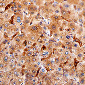 Ninjurin‑1 was detected in immersion fixed paraffin-embedded sections of human liver using Mouse Anti-Human Ninjurin‑1 Monoclonal Antibody (Catalog # MAB51051) at 15 µg/mL overnight at 4 °C. Before incubation with the primary antibody, tissue was subjected to heat-induced epitope retrieval using Antigen Retrieval Reagent-Basic (Catalog # CTS013). Tissue was stained using the Anti-Mouse HRP-DAB Cell & Tissue Staining Kit (brown; Catalog # CTS002) and counterstained with hematoxylin (blue). Specific staining was localized to Kupffer cells. View our protocol for Chromogenic IHC Staining of Paraffin-embedded Tissue Sections. 
