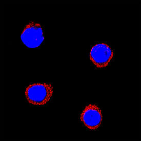 IL‑1 beta /IL‑1F2 was detected in immersion fixed equine peripheral blood mononuclear cells (PBMCs) using Goat Anti-Equine IL‑1 beta /IL‑1F2 Antigen Affinity-purified Polyclonal Antibody (Catalog # AF3340) at 25 µg/mL for 3 hours at room temperature. Cells were stained using the NorthernLights™ 557-conjugated Anti-Mouse IgG Secondary Antibody (red; Catalog # NL007) and counterstained with DAPI (blue). Specific staining was localized to cytoplasm. View our protocol for Fluorescent ICC Staining of Non-adherent Cells.