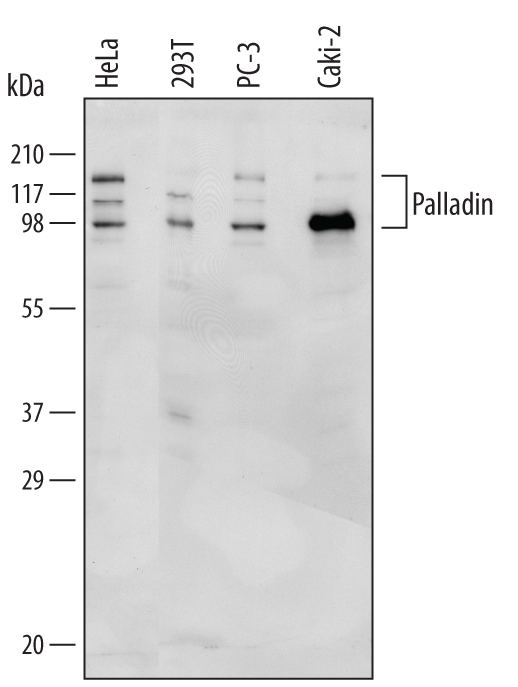 Western blot shows lysates of HeLa human cervical epithelial carcinoma cell line, 293T human embryonic kidney cell line, PC‑3 human prostate cancer cell line, and Caki‑2 human clear cell carcinoma epithelial cell line. PVDF Membrane was probed with 0.5 µg/mL of Human Palladin Antigen Affinity-purified Polyclonal Antibody (Catalog # AF5950) followed by HRP-conjugated Anti-Sheep IgG Secondary Antibody (Catalog # HAF016). Specific bands were detected for Palladin at approximately 95, 115, and 140 kDa (as indicated). This experiment was conducted under reducing conditions and using Immunoblot Buffer Group 1.
