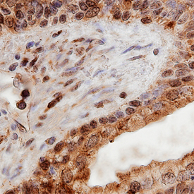 Palladin was detected in immersion fixed paraffin-embedded sections of human prostate using Human Palladin Antigen Affinity-purified Polyclonal Antibody (Catalog # AF5950) at 10 µg/mL overnight at 4 °C. Before incubation with the primary antibody, tissue was subjected to heat-induced epitope retrieval using Antigen Retrieval Reagent-Basic (Catalog # CTS013). Tissue was stained using the Anti-Sheep HRP-DAB Cell & Tissue Staining Kit (brown; Catalog # CTS019) and counterstained with hematoxylin (blue). Specific staining was localized to cytoplasm and nuclei of epithelial cells. View our protocol for Chromogenic IHC Staining of Paraffin-embedded Tissue Sections.