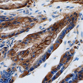 Galectin‑9 was detected in perfusion fixed frozen sections of mouse colon using Rat Anti-Mouse Galectin‑9 Monoclonal Antibody (Catalog # MAB3535) at 25 µg/mL overnight at 4 °C. Tissue was stained using the Anti-Rat HRP-DAB Cell & Tissue Staining Kit  (brown; Catalog # CTS017) and counterstained with hematoxylin (blue). Specific staining was localized to plasma membranes and cytoplasm of epithelial cells. View our protocol for Chromogenic IHC Staining of Frozen Tissue Sections. 