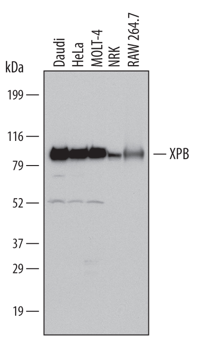 Western blot shows lysates of Daudi human Burkitt's lymphoma cell line, HeLa human cervical epithelial carcinoma cell line, MOLT‑4 human acute lymphoblastic leukemia cell line, NRK rat normal kidney cell line, and RAW 264.7 mouse monocyte/macrophage cell line. PVDF Membrane was probed with 1 µg/mL of Goat Anti-Human/Mouse/Rat XPB Antigen Affinity-purified Polyclonal Antibody (Catalog # AF6349) followed by HRP-conjugated Anti-Goat IgG Secondary Antibody (Catalog # HAF017). A specific band was detected for XPB at approximately 86 kDa (as indicated). This experiment was conducted under reducing conditions and using Immunoblot Buffer Group 1.