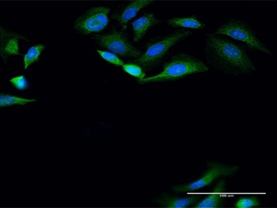 Immunocytochemistry/Immunofluorescence: PANK4 Antibody [H00055229-D01P] - Analysis of antibody to PANK4 on HeLa cell. Antibody concentration 30 ug/ml.