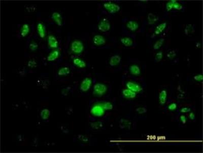 Immunocytochemistry/Immunofluorescence: HHEX Antibody (1A5) [H00003087-M02] - Immunofluorescence of monoclonal antibody to HHEX (H00003087-M02) on HeLa cell. [antibody concentration 10 ug/ml]