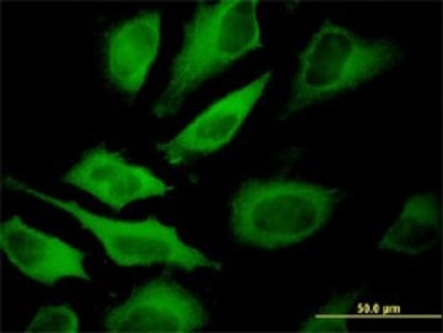 Immunocytochemistry/Immunofluorescence: ATP6V1A Antibody (4F5) [H00000523-M02] - Analysis of monoclonal antibody to ATP6V1A on HeLa cell. Antibody concentration 10 ug/ml.