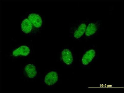 Immunocytochemistry/Immunofluorescence: TIP120A Antibody (4D10) [H00055832-M04] - Analysis of monoclonal antibody to CAND1 on HeLa cell. Antibody concentration 10 ug/ml