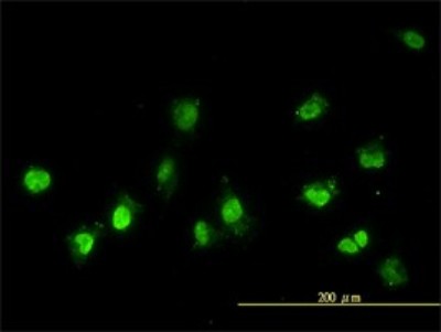 Immunocytochemistry/Immunofluorescence: NEK11 Antibody (4E1-1F4) [H00079858-M01] - Analysis of monoclonal antibody to NEK11 on HeLa cell. Antibody concentration 10 ug/ml.