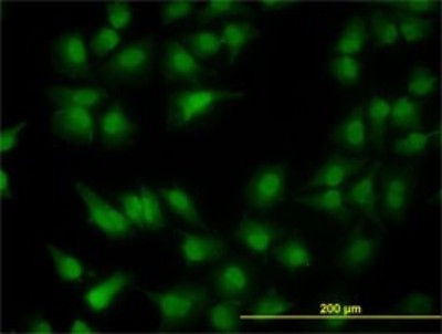 Immunocytochemistry/Immunofluorescence: PDCD2L Antibody (5F9) [H00084306-M01] - Analysis of monoclonal antibody to MGC13096 on HeLa cell. Antibody concentration 10 ug/ml.