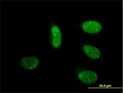 Immunocytochemistry/Immunofluorescence: MED17 Antibody (4D4) [H00009440-M01] - Analysis of monoclonal antibody to CRSP6 on HeLa cell. Antibody concentration 10 ug/ml.