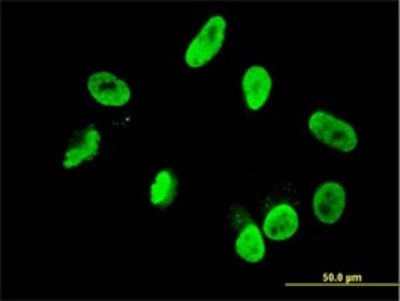 Immunocytochemistry/Immunofluorescence: RNF168 Antibody (3E1) [H00165918-M01] - Analysis of monoclonal antibody to RNF168 on HepG2 cell. Antibody concentration 10 ug/ml.