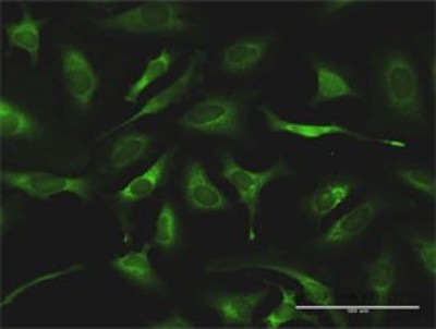Immunocytochemistry/Immunofluorescence: QARS Antibody [H00005859-D01P] - Analysis of antibody to QARS on HeLa cell. Antibody concentration 10 ug/ml.
