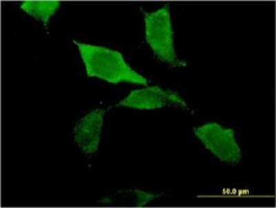 Immunocytochemistry/Immunofluorescence: ZBP1/DLM-1/DAI Antibody (2C10) [H00081030-M01] - Analysis of monoclonal antibody to ZBP1 on HeLa cell. Antibody concentration 10 ug/ml.