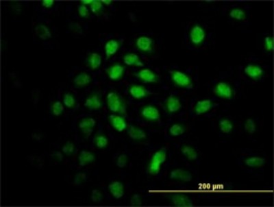 Immunocytochemistry/Immunofluorescence: ALS2CR8 Antibody (2A3) [H00079800-M01] - Analysis of monoclonal antibody to ALS2CR8 on HeLa cell. Antibody concentration 10 ug/ml.