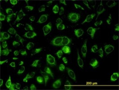 Immunocytochemistry/Immunofluorescence: CGI-16 Antibody (4E4) [H00023597-M01] - Analysis of monoclonal antibody to ACOT9 on HeLa cell. Antibody concentration 10 ug/ml.
