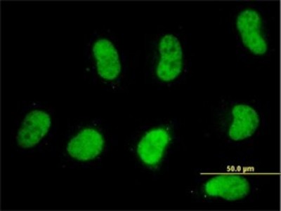 Immunocytochemistry/Immunofluorescence: SMARCD2 Antibody (2B2) [H00006603-M02] - Analysis of monoclonal antibody to SMARCD2 on HeLa cell. Antibody concentration 10 ug/ml.