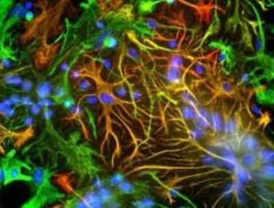 Immunocytochemistry/Immunofluorescence: GFAP Antibody [NB110-93480] - Showing specific labeling of GFAP (red) and vimentin (green) cultured neurons and glia. Cells containing GFAP and vimentin appear yellow.
