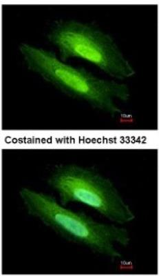 Immunocytochemistry/Immunofluorescence: PDE6D Antibody [NBP1-32730] - Analysis of methanol-fixed HeLa, using antibody at 1:500 dilution.