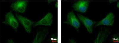 Immunocytochemistry/Immunofluorescence: PPP3CB Antibody [NBP1-32567] - HeLa cells were fixed in ice-cold MeOH for 5 min.  Green: PPP3CB protein stained by PPP3CB antibody.  Blue: Hoechst 33342 staining.