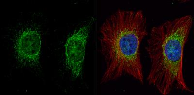 Immunocytochemistry/Immunofluorescence: ACADVL Antibody [NBP2-15238] - HeLa cells were fixed in 4% paraformaldehyde at RT for 15 min. Green: ACADVL protein stained by ACADVL antibody [N1C1] (NBP2-15238) diluted at 1:500. Red: alpha Tubulin, a cytoskeleton marker, stained by alpha Tubulin antibody [GT114] (NBP2-43837) diluted at 1:1000. Blue: Hoechst 33342 staining.