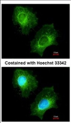 Immunocytochemistry/Immunofluorescence: ECHS1 Antibody [NBP2-16264] - Immunofluorescence analysis of methanol-fixed HeLa, using antibody at 1:200 dilution.